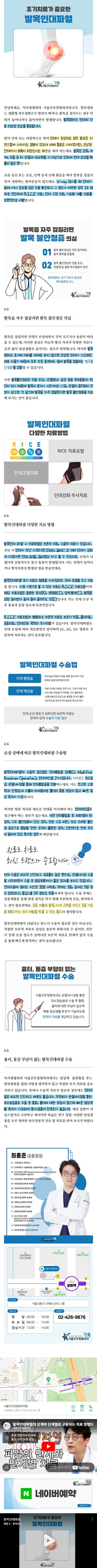 무지외반증보험 nyggp