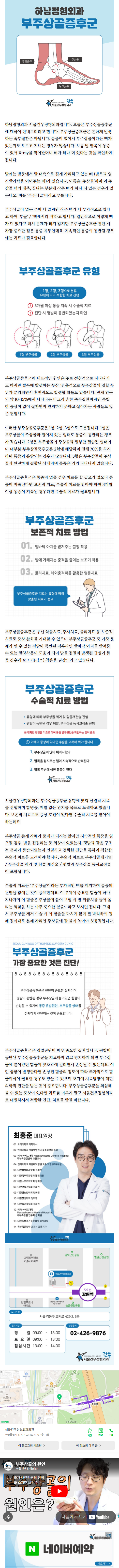 발목골절수술 qwsoh