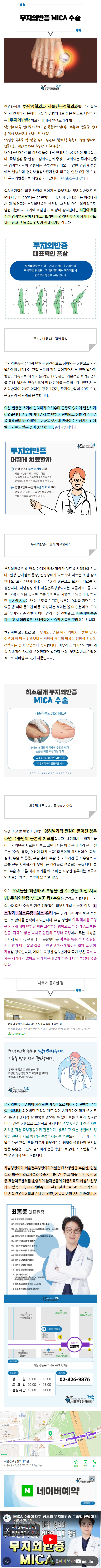 부주상골통증 hrdpd