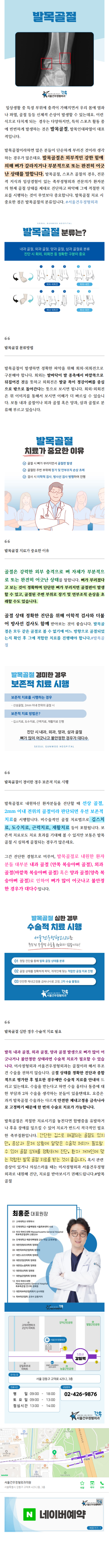 전거비인대파열 vudmf