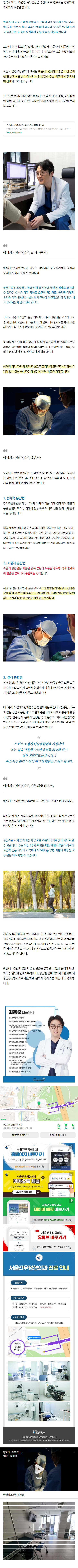 외지무반증 zzjnm